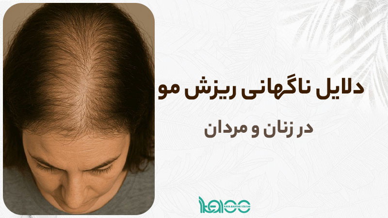 دلایل ناگهانی ریزش مو در زنان و مردان و راه‌های جلوگیری از آن